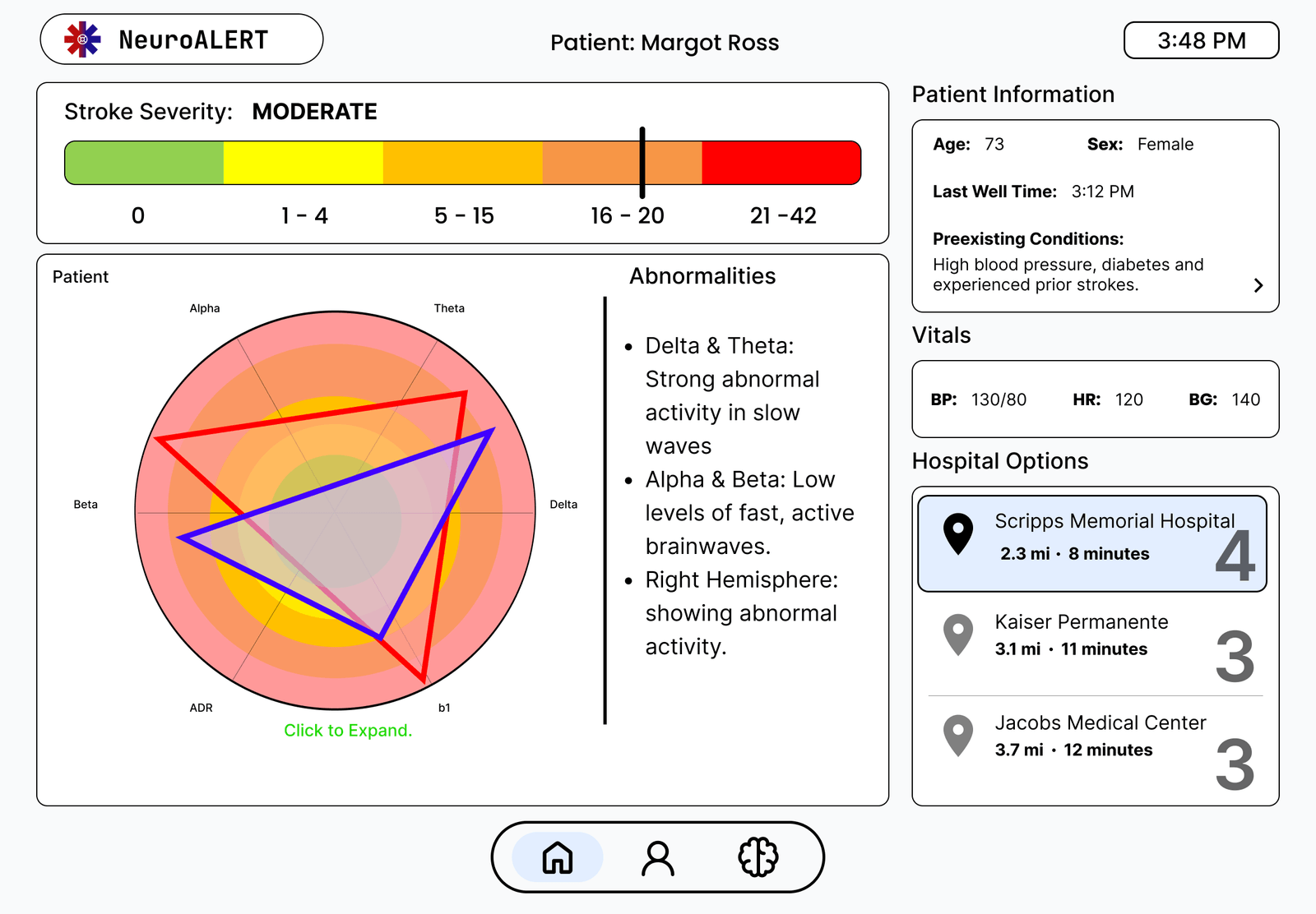 Mid-fi screen showing the EEG data visualization and hospital options