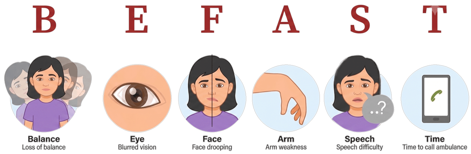 The BEFAST stroke assessment — Balance, Eyes, Face, Arm, Speech, Time